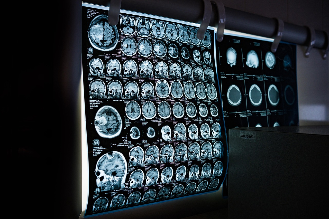 Machine Learning Techniques in Imaging